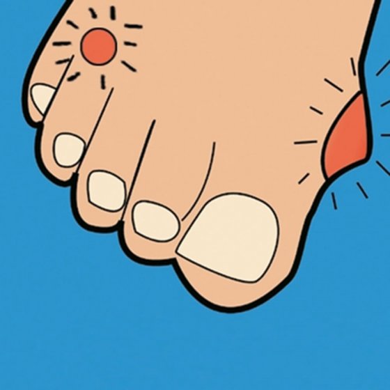 Likdoorn- en eeltstift