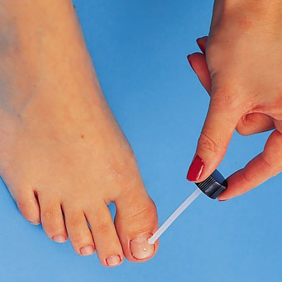 Nail-Fix nagelverzorging