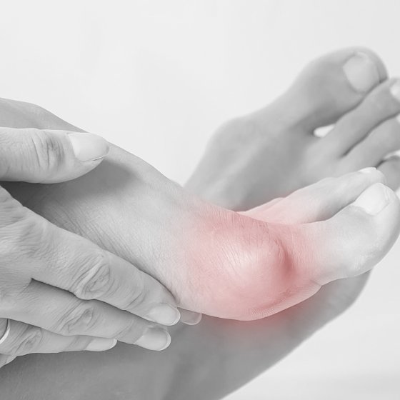 Fussgut verzorgende hallux-balsem 100 ml 