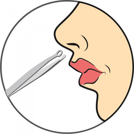 Pincetschaar