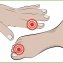 Vinger- en teenbescherming - 4