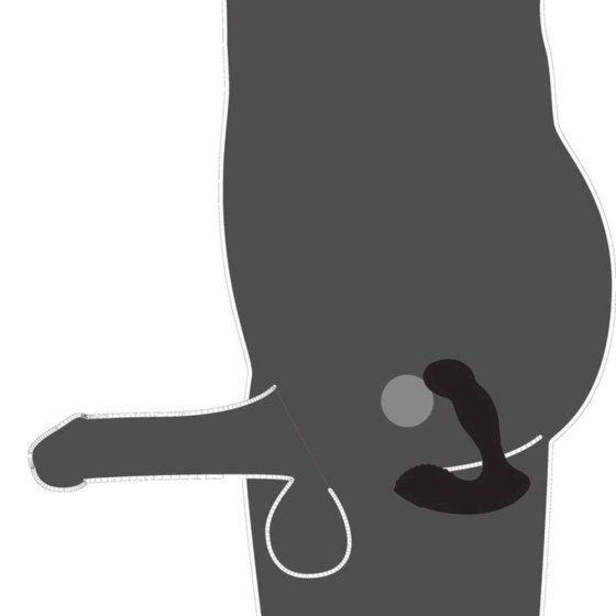 Prostaatvibrator 